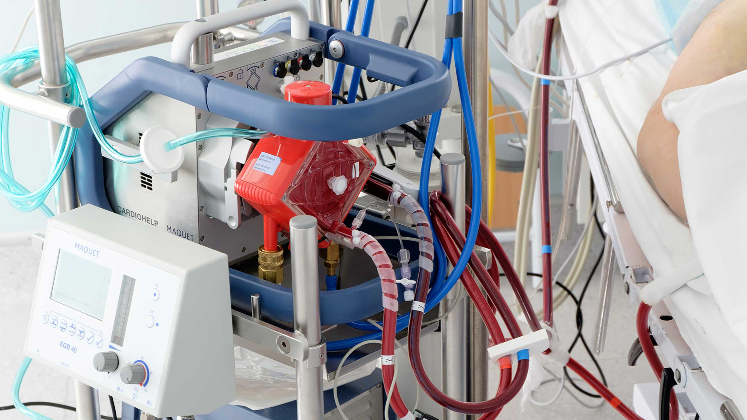 stock image of medical equipement using extracorporeal membrane oxygenation, or ECMO technology