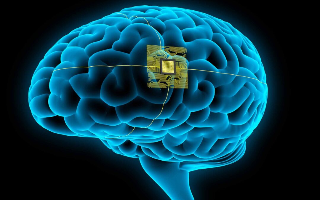 The future of brain implants