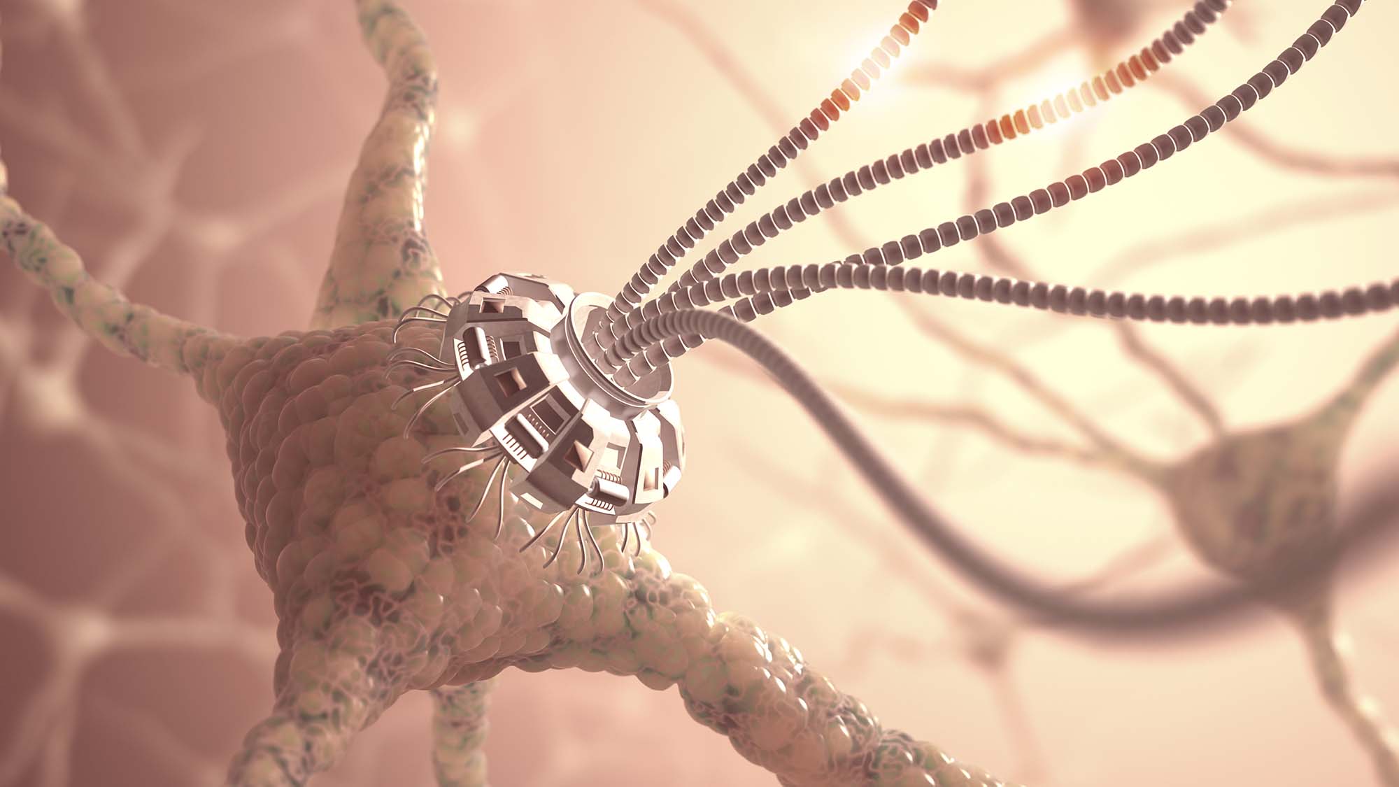A stylized depiction of a neuron with a metallic, futuristic implant at its core, connecting with other neurons via extended wires.